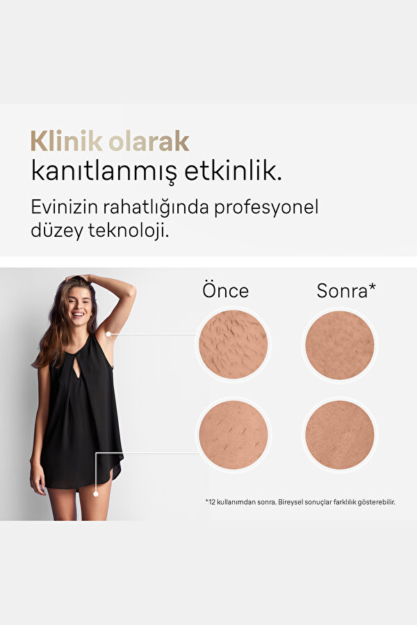 Silk·expert Pro 5 2 Başlıklı IPL Lazer Epilasyon Aleti PL 5146 4